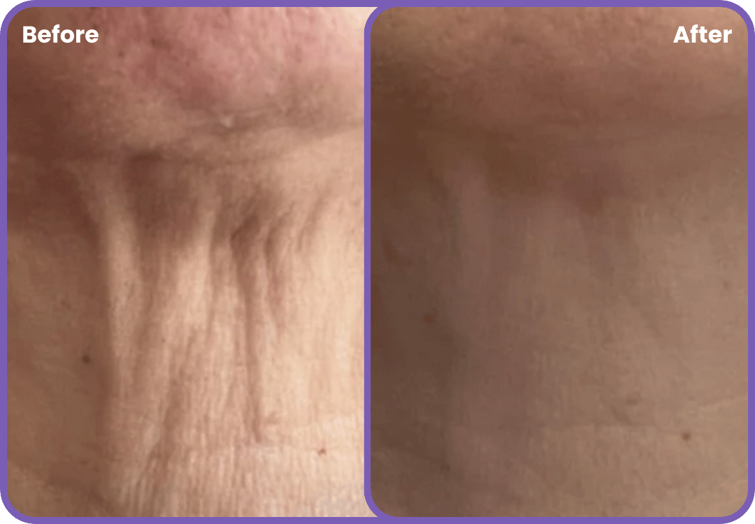 Neck & Lift Cream - Zenova