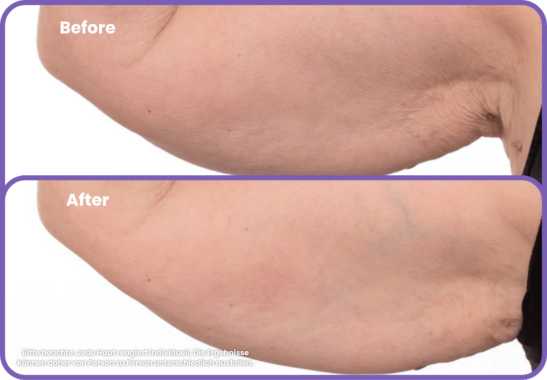 Arm Firming Cream - Zenova