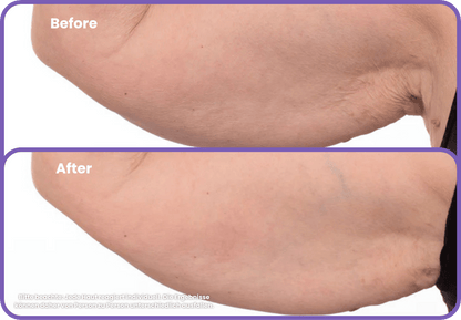 Arm Firming Cream - Zenova