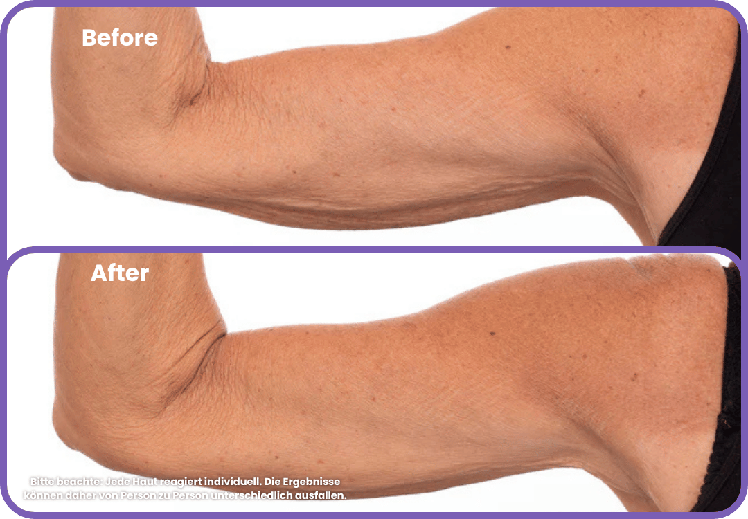 Arm Firming Cream - Zenova