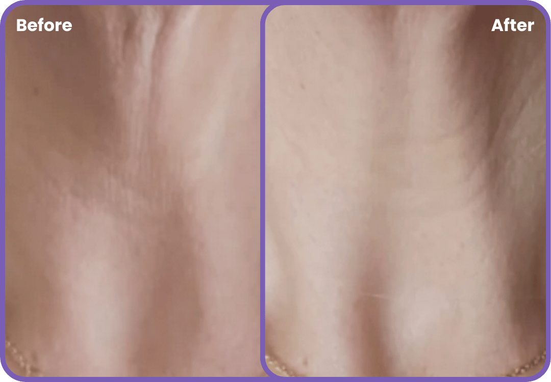 Neck & Lift Cream - Zenova