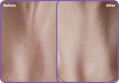 Neck & Lift Cream - Zenova